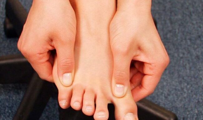 How I Cured My Morton’s Neuroma How I Cured My Morton's Neuroma