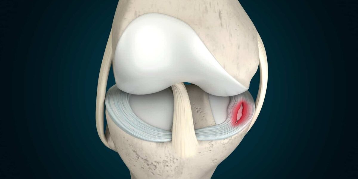 Meniscus Tear Symptoms