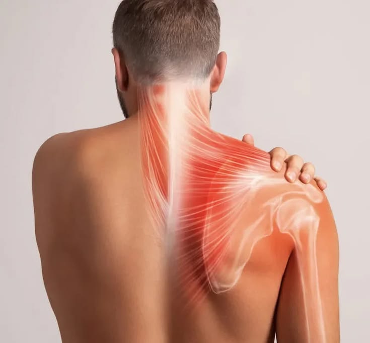Shoulder Subluxation: Causes, Symptoms, Treatment, Recovery, and When Surgery Is Needed