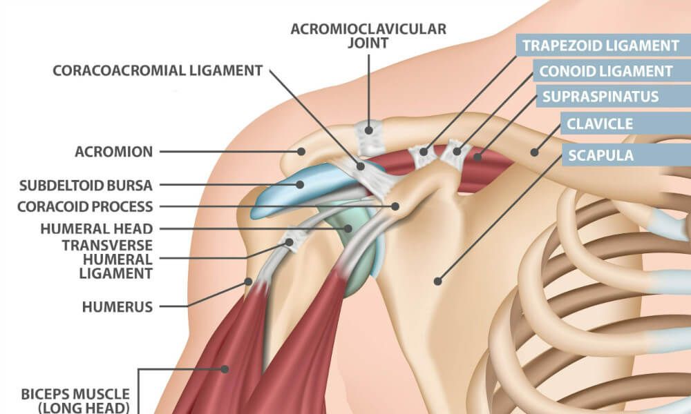 Shoulder Separation: Symptoms, Treatment, Recovery & When to See an Orthopedic Surgeon