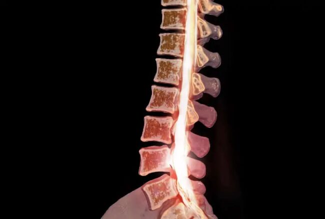 Herniated Disc: Symptoms, Causes, and Treatment Options Explained