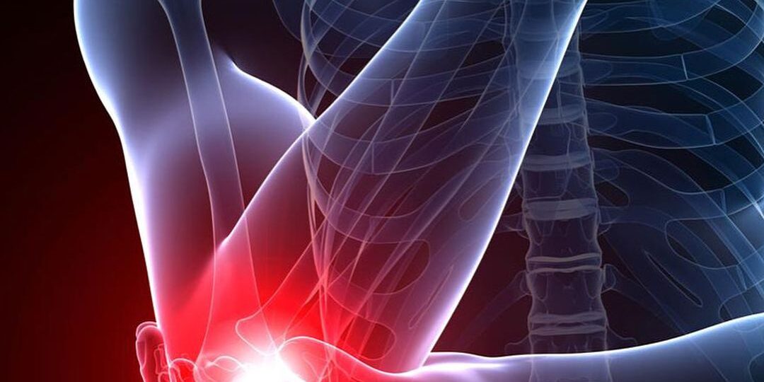 Pain While Bending Elbow: Causes, Symptoms, Treatment & When to See a Doctor Pain While Bending Elbow: Causes, Symptoms, Treatment & When to See a Doctor