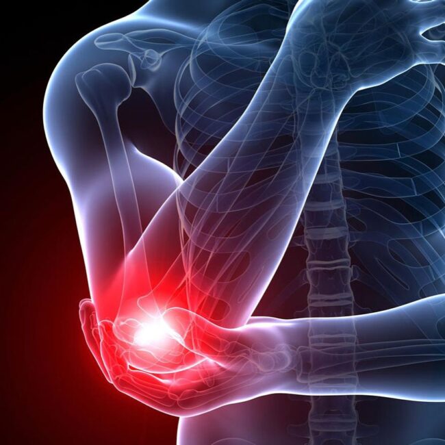 Pain While Bending Elbow: Causes, Symptoms, Treatment & When to See a Doctor
