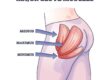 What Are Glutes? A Clear Guide to Your Gluteal Muscles