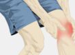 Can a Swollen Knee Be Dangerous?
