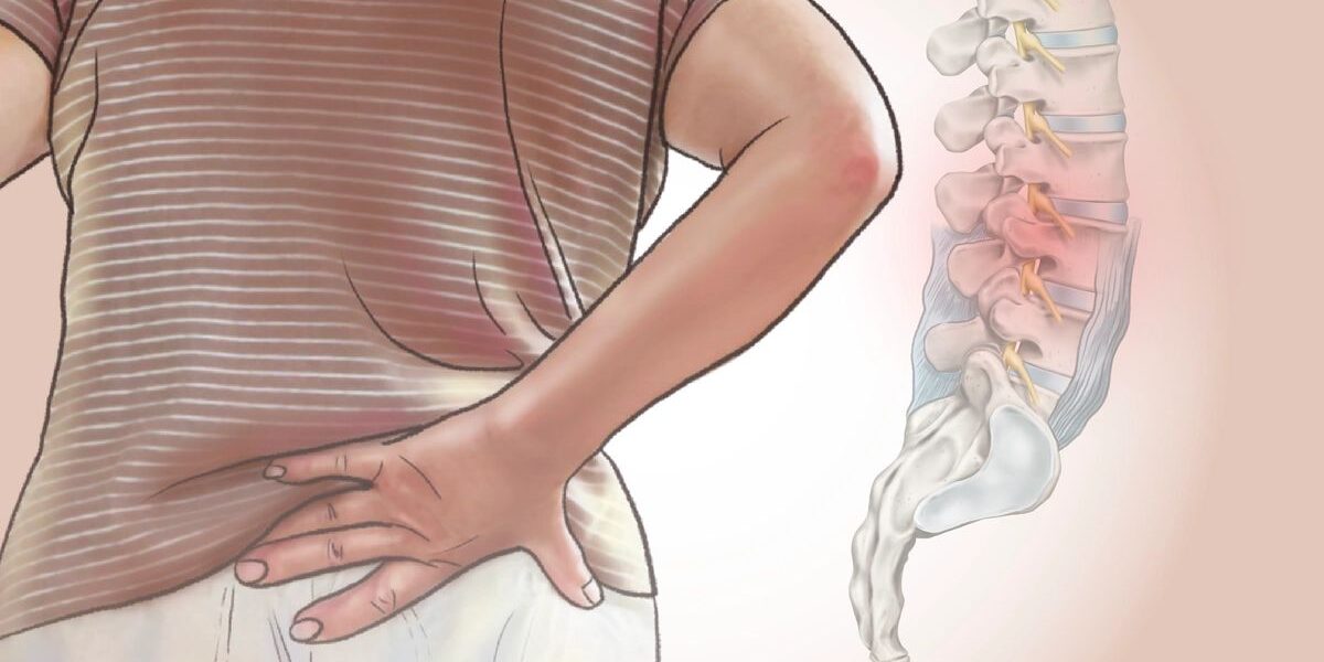 Lower Back Pain Causes: A Clear Guide to Why Your Back Hurts