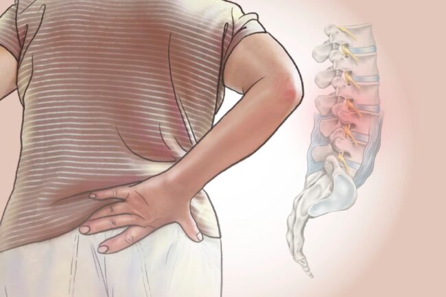 Lower Back Pain Causes: A Clear Guide to Why Your Back Hurts