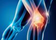 Unstable Knee: Causes, Symptoms, and When to Seek Help